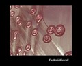 escherichia coli